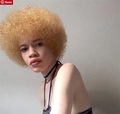 black albino porn|'african albino' Search .